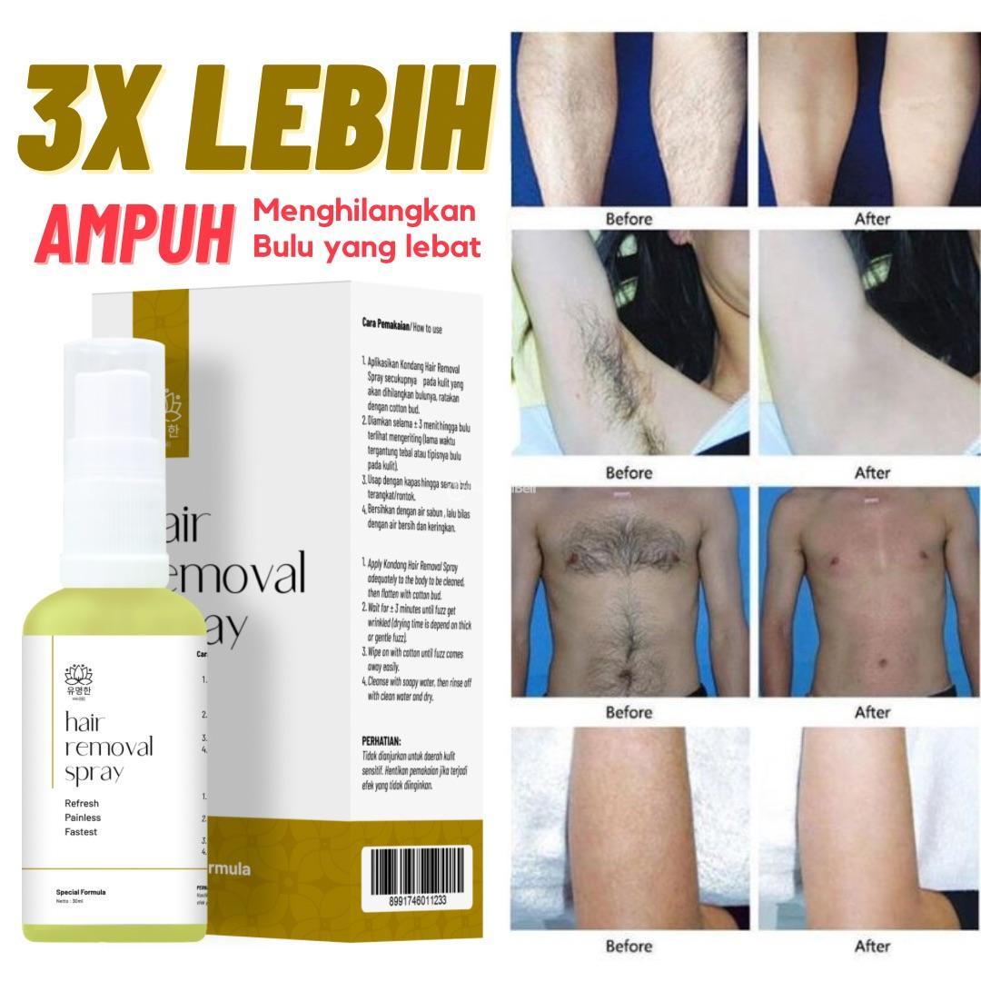 Waxing Bulu Ketiak Kaki Dan Tangan Kondang Hair Removal Spray Di