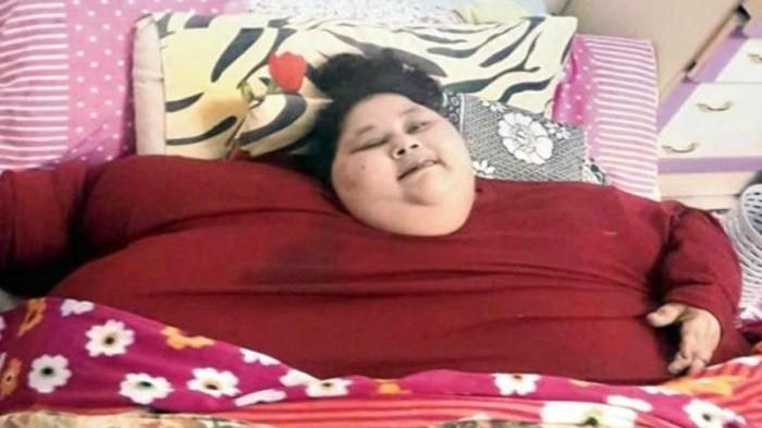 Tak Disangka Dari 500 Kg Berat Badan Wanita Ini Jadi Segini Bahkan