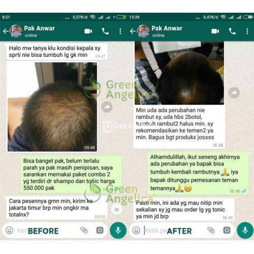 Hair Tonic Green Angelica Obat Penebal Rambut Paling Ampuh, Obat Rambut Rontok - Cilegon