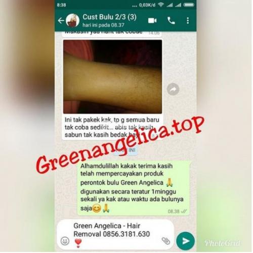 Perontok Bulu Ketiak Hair Removal Green Angelica Tanpa Efek Samping - Balikpapan