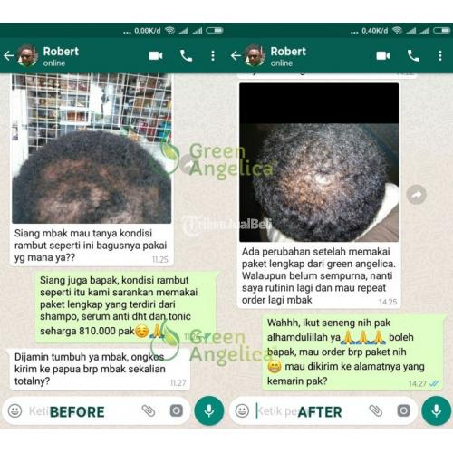 Perawatan Rambut Rontok, Penipisan Rambut Atasi Paket Combo 2 Green Angelica - Manado