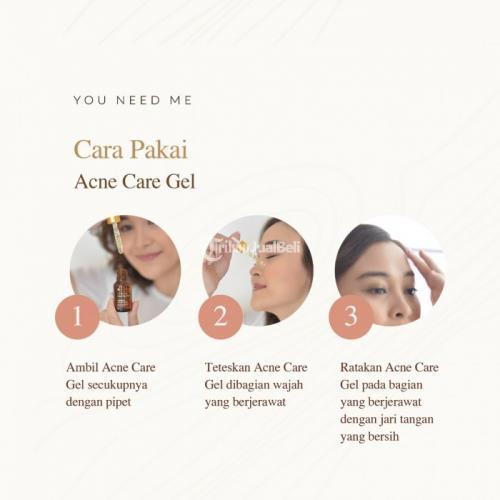 Obat Jerawat Meradang Paling Ampuh, You Need Me Acne Care Gel - Surabaya