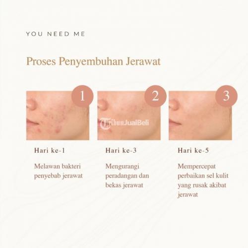 Serum Penghilang Jerawat Acne Care Gel - Surabaya
