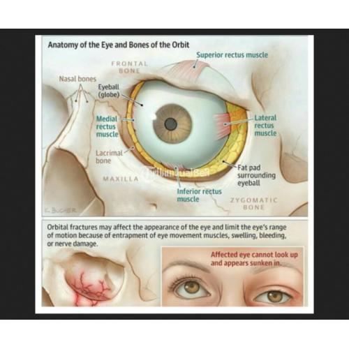 FoCuson Asli Solusi Mata Sehat Memulihkan Penglihatan Anda jmggroup.store