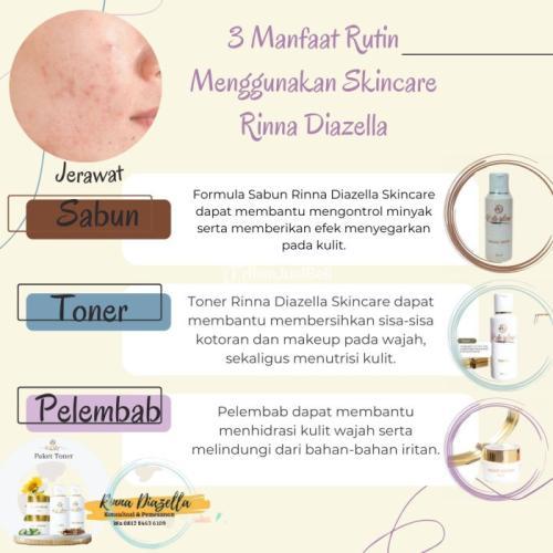 Paket Produk Rinna Diazella Ampuh Banget Mengusir Munculnya Jerawat Membandel Di Wajah