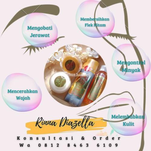 Produk Rinna Diazella Teruji Meminimalisir Munculnya Jerawat Di Wajah