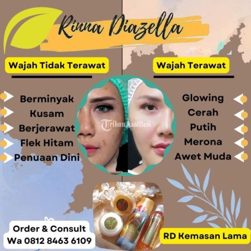 Cream RD Skincare Untuk Mengatasi Jerawat Di Kulit Muka Relatif Singkat - Cilegon