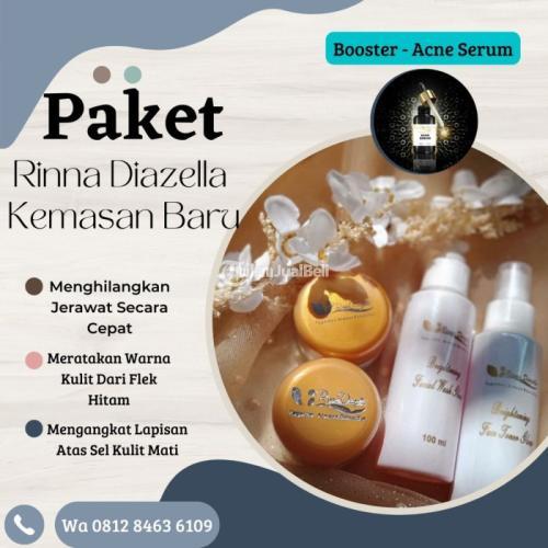 Cream Rinna Diazella Mampu Menyembuhkan Kulit Muka Yang Berjerawat Dengan Singkat - Bojonegoro