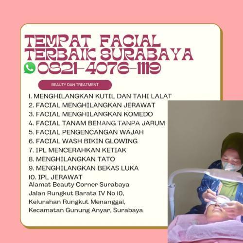 Jangka Waktu Ipl Ketiak Di Pepe Sidoarjo