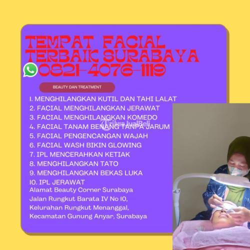 Jangka Waktu Ipl Ketiak Di Pepe Sidoarjo di Surabaya Tribun JualBeli