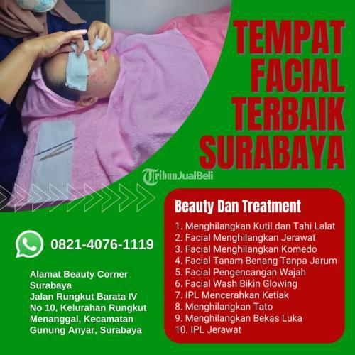 Facial Wash Aloe Vera Yang Bagus Di Rungkut Kidul Surabaya