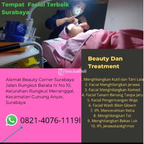 Cauter Wajah Harga Tambak Oso - Surabaya