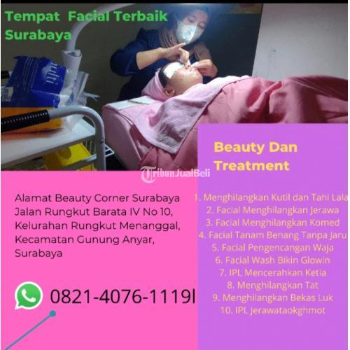Cauter Wajah Harga Tambak Oso - Surabaya