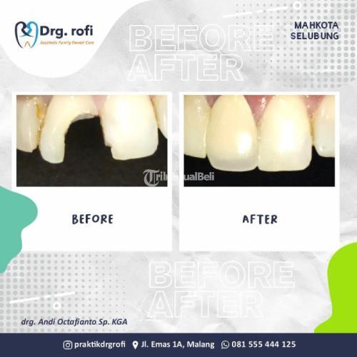 Klinik Dokter Gigi Bagus Malang | HP/WA: 0815-5544-4125