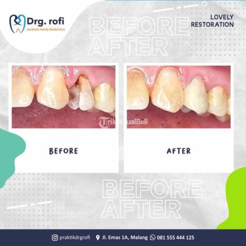 Klinik Gigi Terbaik Malang Pelayanan Terbaik Tenaga Profesional - Malang