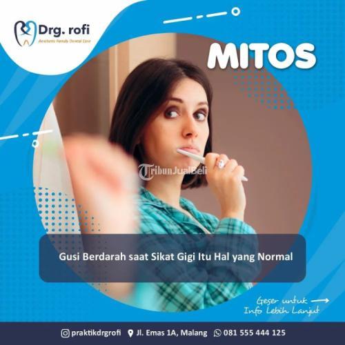 Klinik Gigi Di Malang | HP/WA: 0815-5544-4125