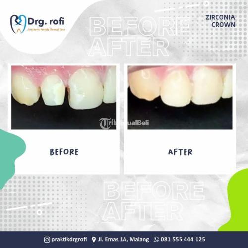 Klinik Gigi Terbaik Berkualitas Malang | HP/WA: 0815-5544-4125