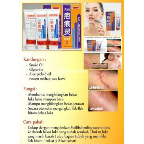 WA 0852-7060-4590 Obat Penghilang Bekas Borok Di Medan