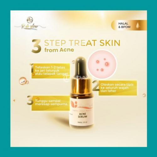 100 Asli,Manfaat Acne Serum Rinna Diazella Untuk Menyembuhkan Jerawat Meradang.
