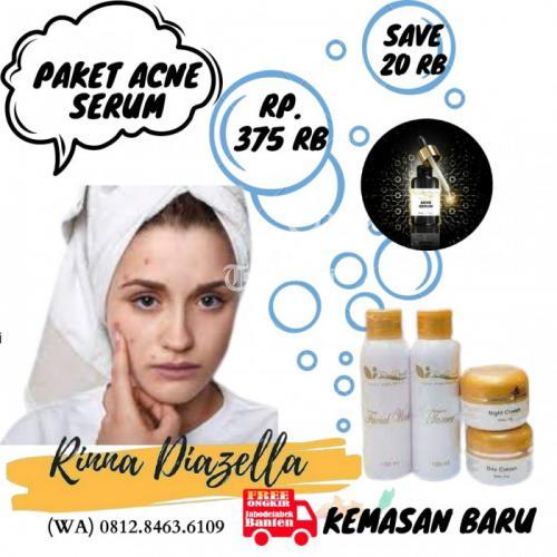 100 Asli,Manfaat Acne Serum Rinna Diazella Untuk Menyembuhkan Jerawat Meradang.