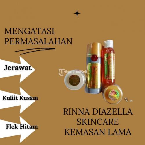 Apakah RD Kemasan Lama Dapat Dipakai Untuk Masalah Flek Hitam Yang Di Muka