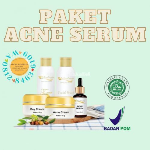 Apakah Acne Serum Rinna Diazella Mampu Mengobati Jerawat Meradang ?