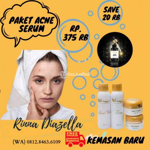 Apakah Acne Serum Rinna Diazella Mampu Mengobati Jerawat Meradang ?