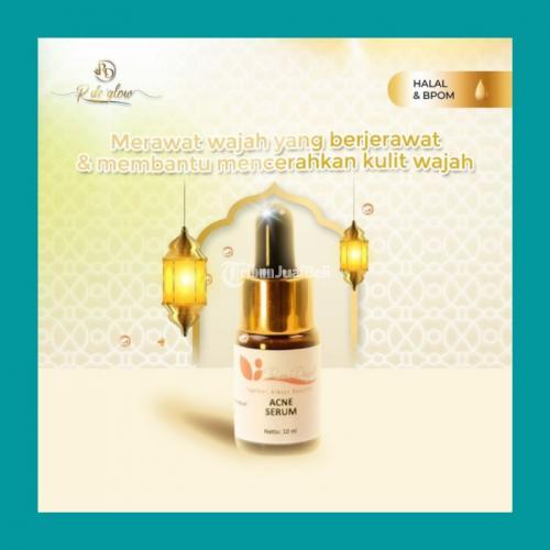 Apakah Acne Serum Rinna Diazella Mampu Mengobati Jerawat Meradang ?