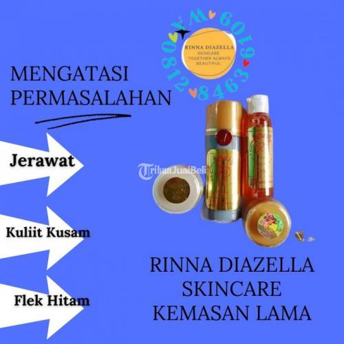 Kegunaan Paket Toner Rd Kemasan Lama Untuk Flek Hitam Di Muka