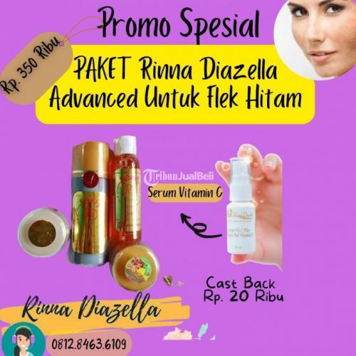 Krim RD Kemasan Lama Untuk Flek Hitam Di Wajah