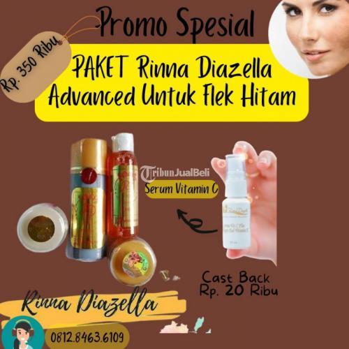 Manfaat Krim Rd Kemasan Lama Untuk Masalah Flek Hitam Yang Di Muka