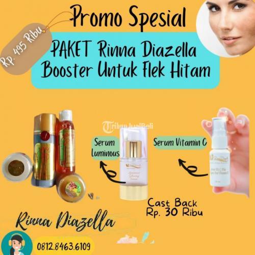 Manfaat Krim Rd Kemasan Lama Untuk Masalah Flek Hitam Yang Di Muka