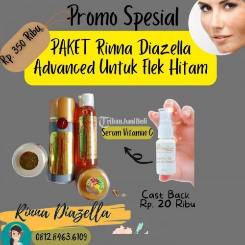 Tips Pakai Paket Toner RD Kemasan Lama yang Benar di Kulit Muka