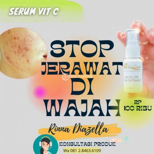 serum Vit c rinna diazella untuk Kulit Berjerawat,Bebas Ongkir