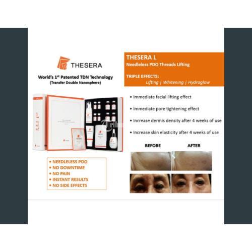 Tesera L Kit Tanam Benang Tanpa Jarum