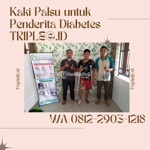 WA 0812-2903-1218, Kaki Palsu untuk Penderita Diabetes TRIPLE@.ID