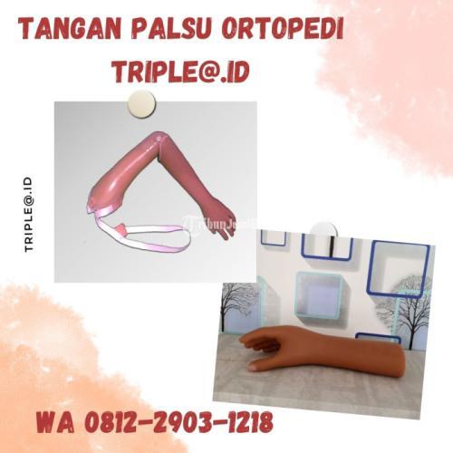 Jasa Pembuatan Tangan Palsu Ortopedi - Sragen
