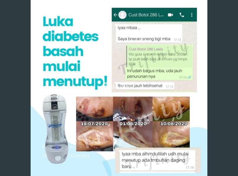 Diabetes kencing manis turun gula darah tanpa obat herbal atau insulin