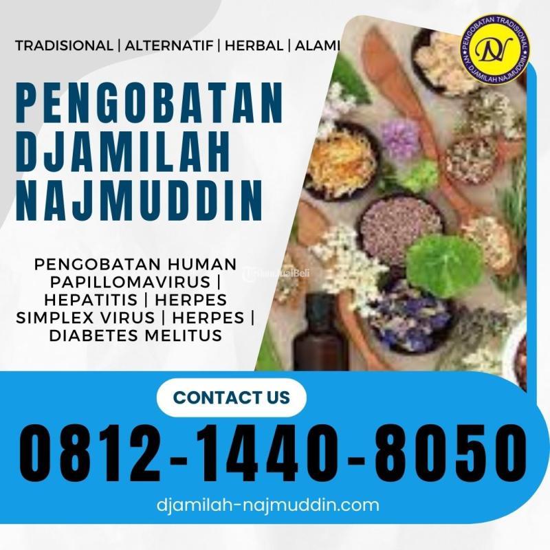 Terapi Herpes Simpleks Ny. Djamilah Najmuddin di Sukaraja di Bandung ...