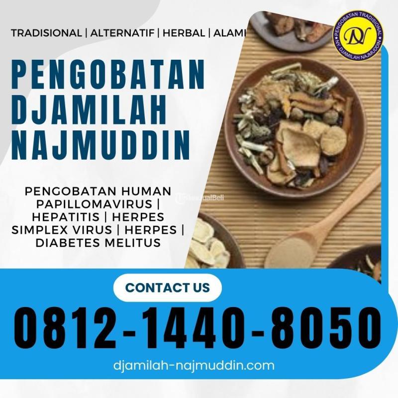 Pengobatan Hepatitis A Pada Anak Ny. Djamilah Najmuddin Di Gegerkalong ...