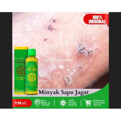 Obat Gatal Scabies, Obat Scabies Manusia, Obat Pembasmi Kudis Scabies