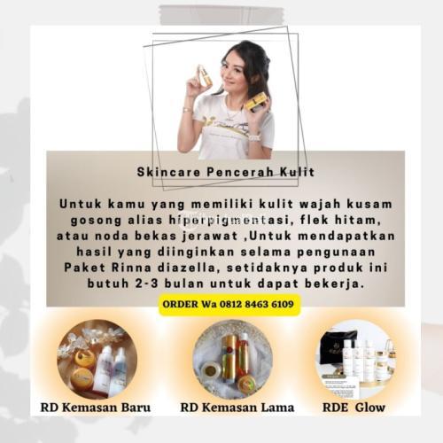 Rinna Diazella Skin care Menyembuhkan Wajah Berjerawat & Flek hitam,Jawa Timur,Lumajang