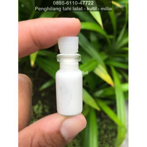 Obat Penghilang Tahi Lalat Tanpa Bekas - Bandung
