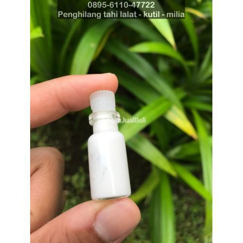 Obat Menghilangkan Tahi Lalat di Wajah - Bandung