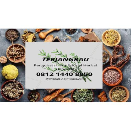 Terjangkau obat alami asam urat di jempol kaki Rancanumpang Bandung
