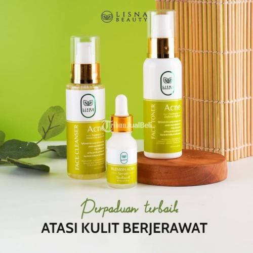 Ampuh Mengatasi Jerawat Membandel