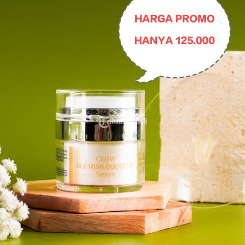 Tips Mengatasi Keriput Wajah dan Penuaan Dini