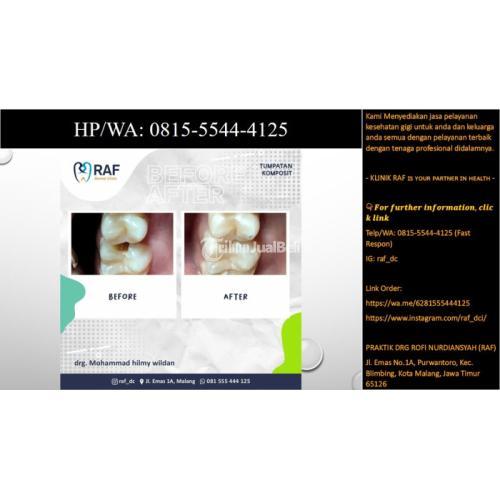 Klinik Gigi Terbaik Di Malang | HP/WA: 0815-5544-4125