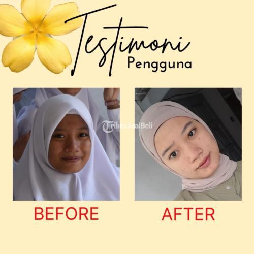 Pemutih Kulit dan Pencerah Wajah Alami Vitaline SoftGels Ampuh dalam 1 Bulan