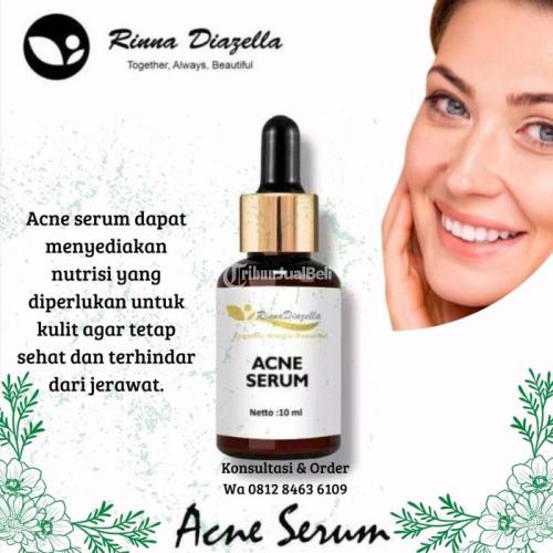 ⚪️ Kulit Wajah Bersih & Cantik Bebas Jerawat Dengan Acne Serum Rinna Diazella Skincare